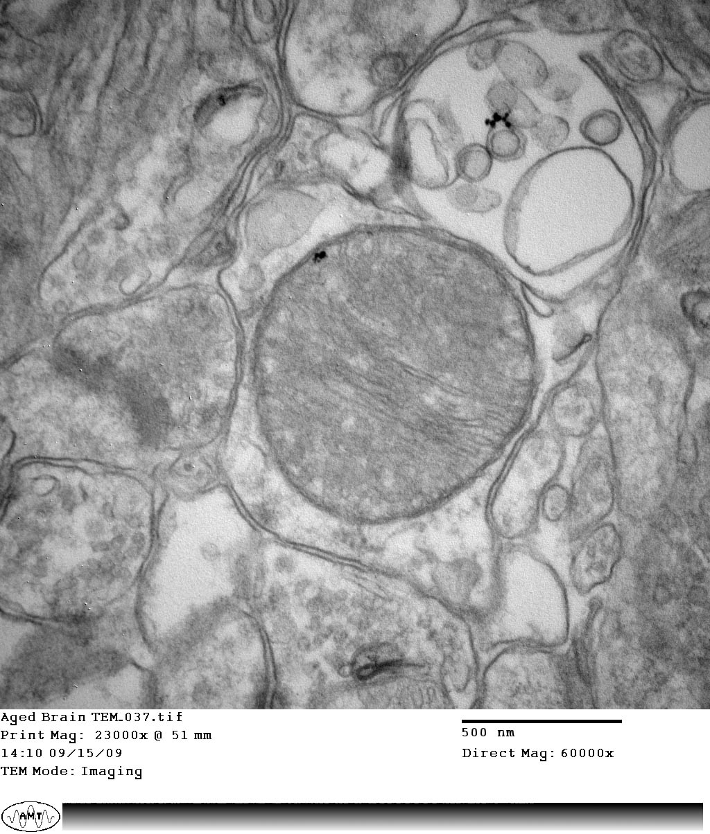 Transmission electron micrograph with original annotations