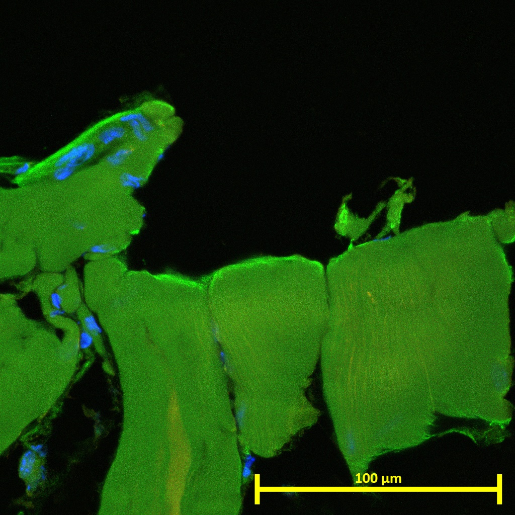 Original laboratory fluorescence micrograph, with the 100 micrometer scale bar retained